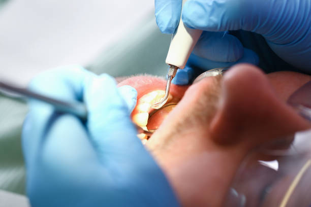 Best Pediatric Emergency Dentist in Mauriceville, TX
